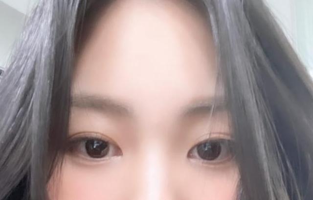 권은빈
