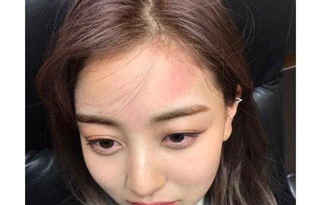 정연에게 맞은 지효