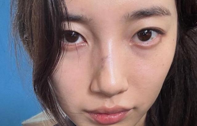 수지 인별 기가영/ 나의리얼오판금